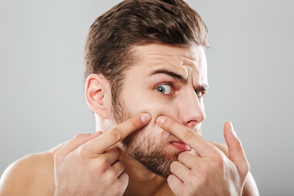 periorbital cellulitis