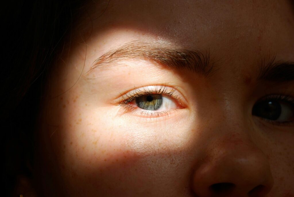why are my eyelids puffy