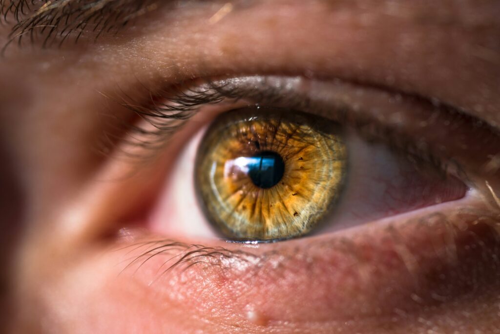 yellow eyes causes